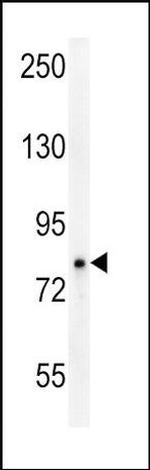 OCA2 Antibody in Western Blot (WB)