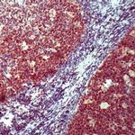 Oct-2 Antibody in Immunohistochemistry (IHC)