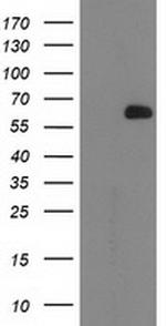 OGFOD1 Antibody in Western Blot (WB)