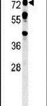 OLFML2A Antibody in Western Blot (WB)