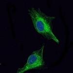 OLIG2 Monoclonal Antibody (1G11)