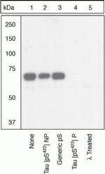 Phospho-Tau (Ser422) Antibody in Western Blot (WB)