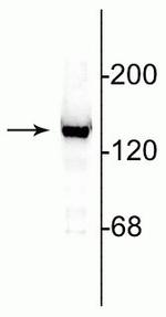 NMDAR2C Polyclonal Antibody
