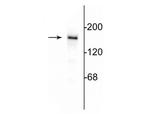 NMDAR2B Polyclonal Antibody