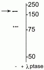 Phospho-NMDAR2B (Tyr1472) Antibody in Western Blot (WB)