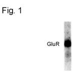 Phospho-GluR1 (Ser831) Antibody in Western Blot (WB)