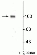Phospho-GluR1 (Ser845) Polyclonal Antibody