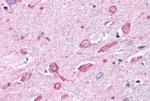 MC4R Antibody in Immunohistochemistry (Paraffin) (IHC (P))