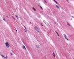beta-2 Adrenergic Receptor Antibody in Immunohistochemistry (IHC)
