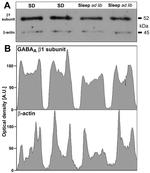 GABRB1 Antibody in Western Blot (WB)