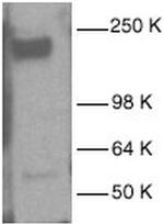 EGFR Polyclonal Antibody