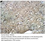 OR14I1 Polyclonal Antibody