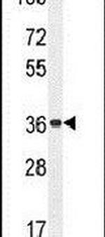 OR4A47 Antibody in Western Blot (WB)