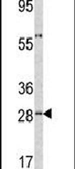 ORM1 Antibody in Western Blot (WB)