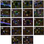 Beclin 1 Antibody in Immunohistochemistry (IHC)
