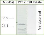 DRAM Antibody in Western Blot (WB)