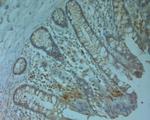 ABCC6 Antibody in Immunohistochemistry (Paraffin) (IHC (P))