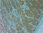 ABCC6 Antibody in Immunohistochemistry (Paraffin) (IHC (P))