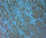 ABCC6 Antibody in Immunohistochemistry (Paraffin) (IHC (P))