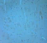WDFY3 Antibody in Immunohistochemistry (Paraffin) (IHC (P))