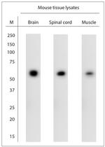 Atlastin 2 Antibody in Western Blot (WB)