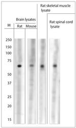 ASIC1 Antibody in Western Blot (WB)