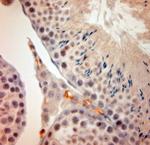 ACE2 Antibody in Immunohistochemistry (Paraffin) (IHC (P))