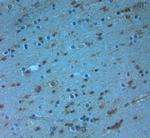 Bassoon Antibody in Immunohistochemistry (Paraffin) (IHC (P))