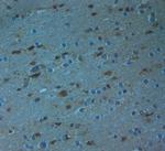 Bassoon Antibody in Immunohistochemistry (Paraffin) (IHC (P))