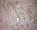 BBS2 Antibody in Immunohistochemistry (Paraffin) (IHC (P))