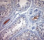 BBS2 Antibody in Immunohistochemistry (Paraffin) (IHC (P))