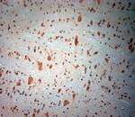 BDKRB2 Antibody in Immunohistochemistry (Paraffin) (IHC (P))