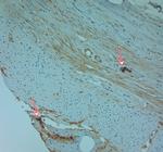 Cathelicidin Antibody in Immunohistochemistry (Paraffin) (IHC (P))
