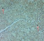 Cathelicidin Antibody in Immunohistochemistry (Paraffin) (IHC (P))