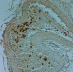 Cathelicidin Antibody in Immunohistochemistry (Paraffin) (IHC (P))