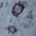 Contactin 1 Antibody in Immunohistochemistry (IHC)