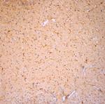 Cofilin 1 Antibody in Immunohistochemistry (Paraffin) (IHC (P))