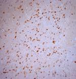 Stargazin Antibody in Immunohistochemistry (Paraffin) (IHC (P))