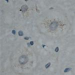 Cullin 5 Antibody in Immunohistochemistry (Paraffin) (IHC (P))