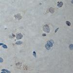 Cullin 5 Antibody in Immunohistochemistry (Paraffin) (IHC (P))