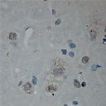 Cullin 5 Antibody in Immunohistochemistry (Paraffin) (IHC (P))