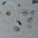 Cullin 5 Antibody in Immunohistochemistry (Paraffin) (IHC (P))