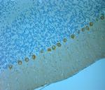 CALB1 Antibody in Immunohistochemistry (Paraffin) (IHC (P))