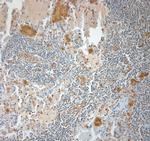 CD36 Antibody in Immunohistochemistry (Paraffin) (IHC (P))