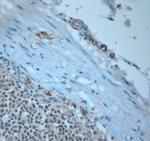 CD36 Antibody in Immunohistochemistry (Paraffin) (IHC (P))