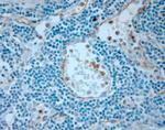 CD36 Antibody in Immunohistochemistry (Paraffin) (IHC (P))