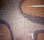 CLCN5 Antibody in Immunohistochemistry (Paraffin) (IHC (P))