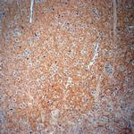 CLCN5 Antibody in Immunohistochemistry (Paraffin) (IHC (P))