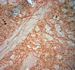 CLCN5 Antibody in Immunohistochemistry (Paraffin) (IHC (P))