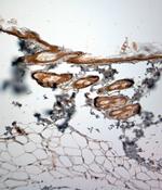 Collagen VII Antibody in Immunohistochemistry (Paraffin) (IHC (P))
